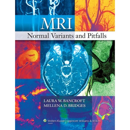 Mri Normal Variants And Pitfalls (2009) 2009