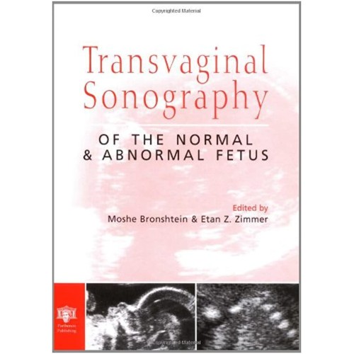 Transvaginal Sonography Of The Normal And Abn...