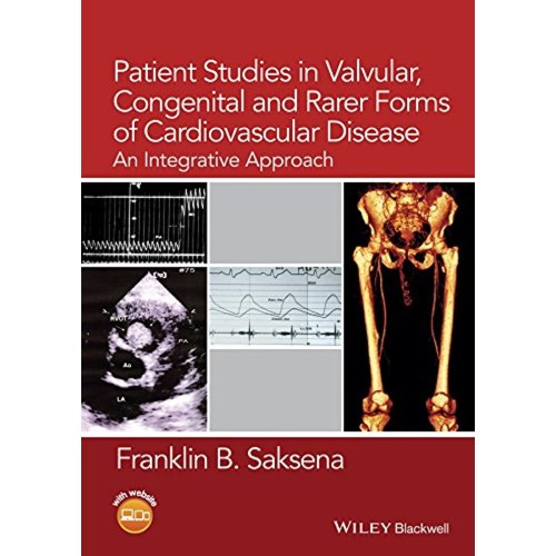 Patient Studies In Valvular Congenital And Ra...