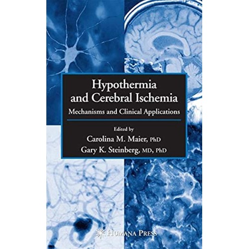 Hypothermia And Cerebral Ischemia: Mechanisms...