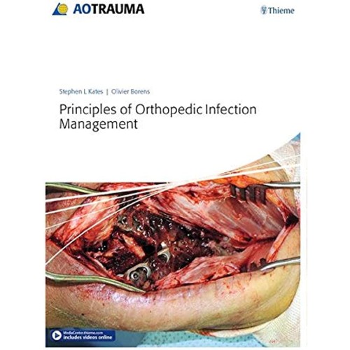 Principles Of Orthopedic Infection Management...