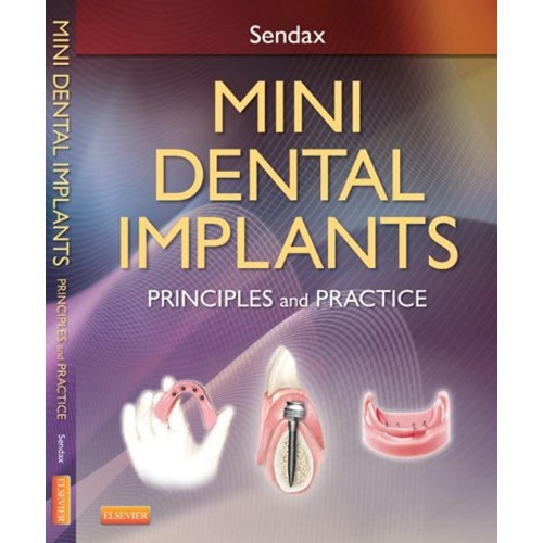 Mini Dental Implants: Principles And Practice...