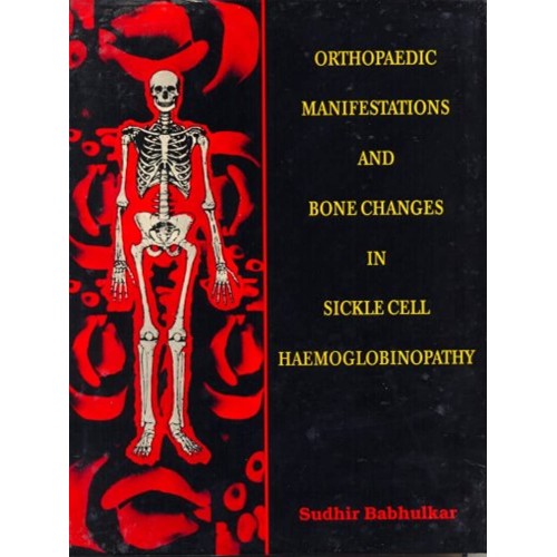 Orthopaedic Manifestations And Bone Changes I...