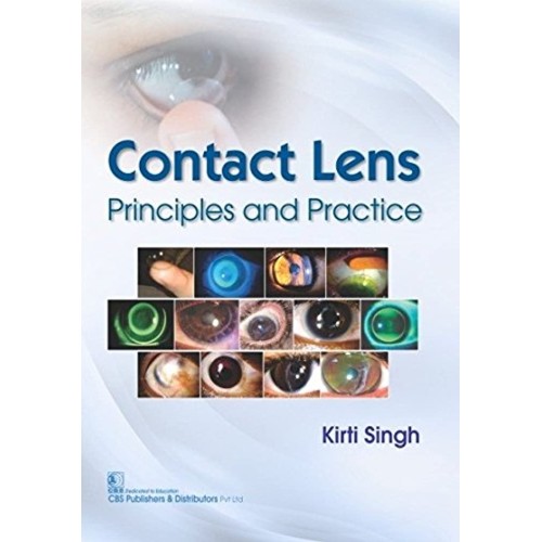 Contact Lens Principles And Practice (Pb 2017...