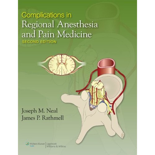 Complications In Regional Anesthesia And Pain...