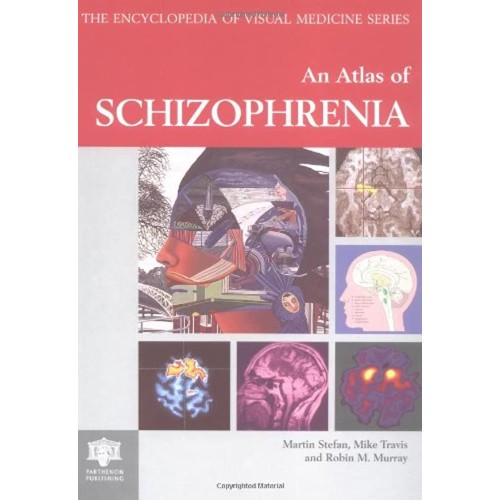 Atlas Of Schizophrenia, Second Edition (Encyc...