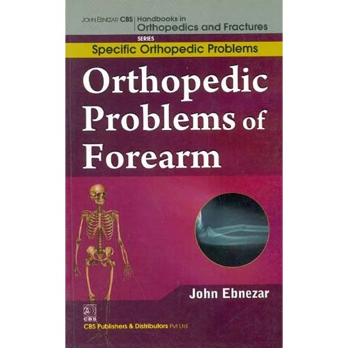 Orthopedic Problems Of Forearm (Handbooks In ...