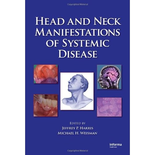 Head And Neck Manifestations Of Systemic Dise...