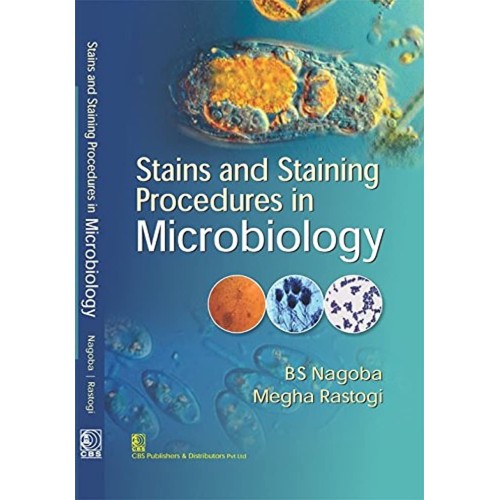 Stains And Staining Procedures In Microbiolog...