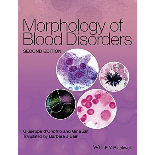 Morphology Of Blood Disorders 2Ed (Hb 2014) 