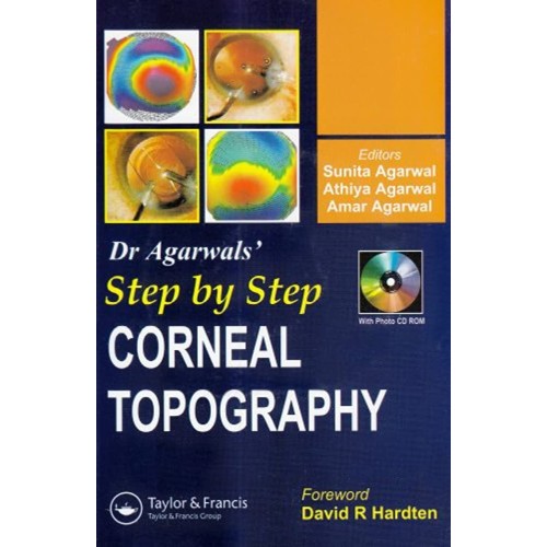 Step By Step Corneal Topography 