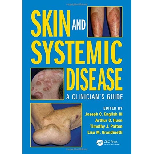 Skin And Systemic Disease A Clinicians Guide ...