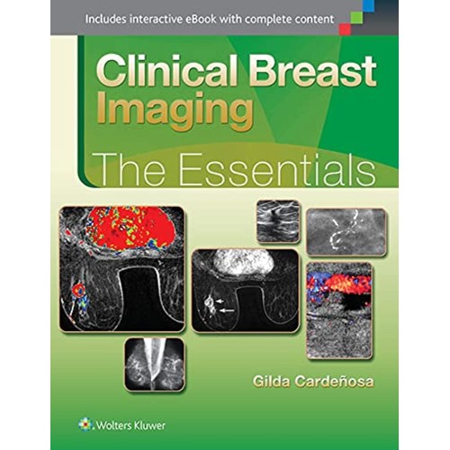 Clinical Breast Imaging The Essentials (Hb 20...