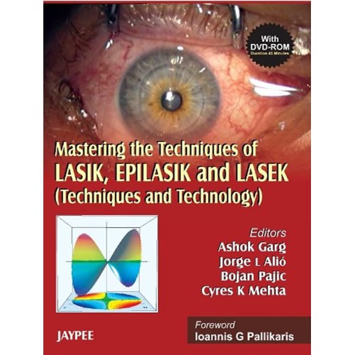 Mastering The Techniques Of Lasik Epilasik An...