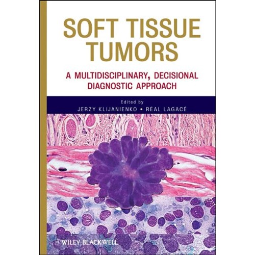 Soft Tissue Tumors:A Multidisciplinary, Decis...