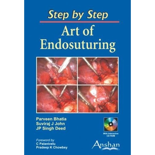 Step By Step Art Of Endosutuing Pb 