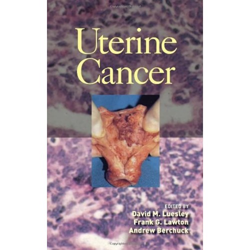 Uterine Cancer 