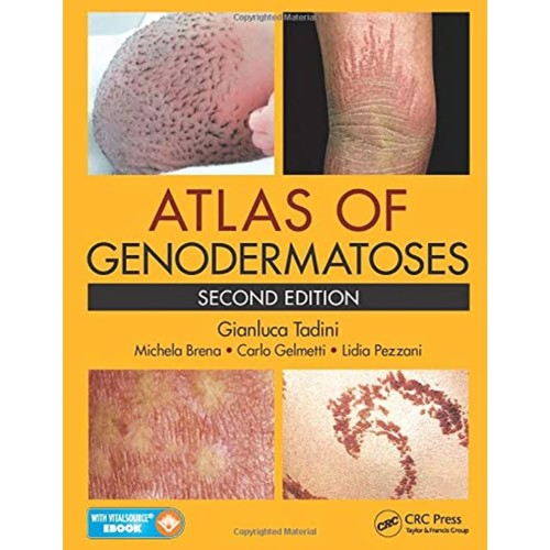 Atlas Of Genodermatoses 2Ed (Hb 2015) 