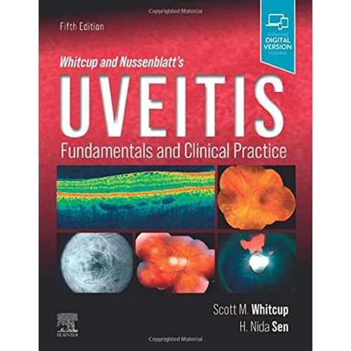 Whitcup And Nussenblatts Uveitis Fundamentals...