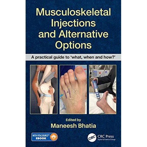 Musculoskeletal Injections And Alternative Op...