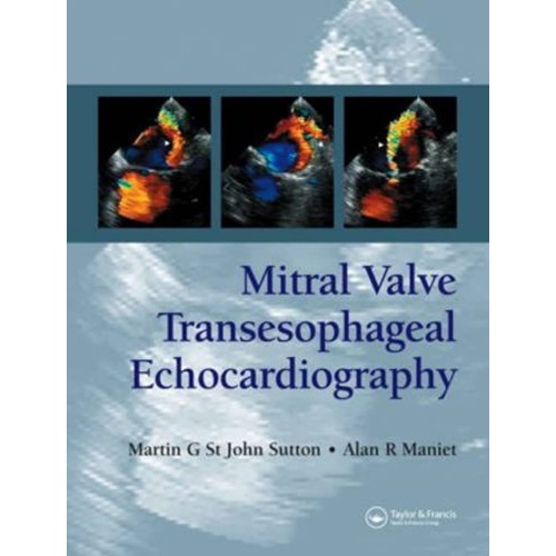 Mitral Valve Transesophageal Echocardiography...