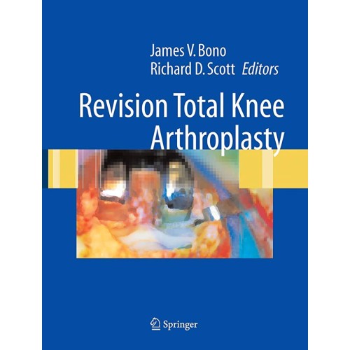 Revision Total Knee Arthroplasty 