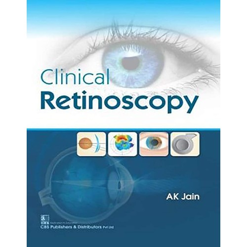 Clinical Retinoscopy (Pb 2019) 