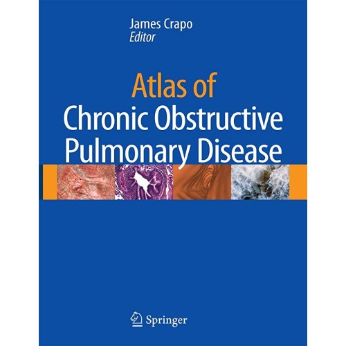 Atlas Of Chronic Obstructive Pulmonary Diseas...