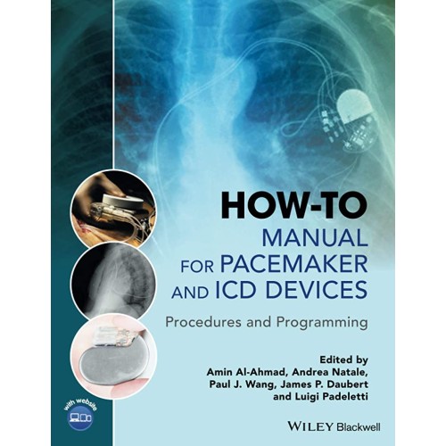 How To Manual For Pacemaker And Icd Devices P...