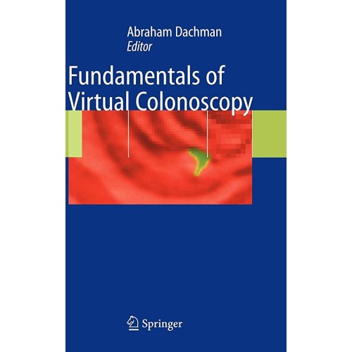 Fundamentals Of Virtual Colonoscopy (Hb) 