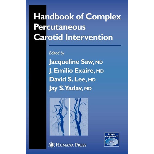 Handbook Of Complex Percutaneous Carotid Inte...