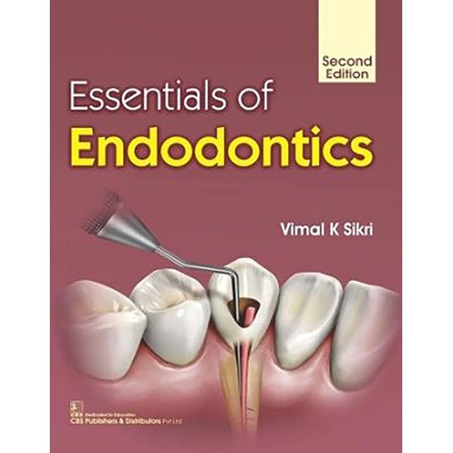 Essentials Of Endodontics 2Ed (Pb 2019) 