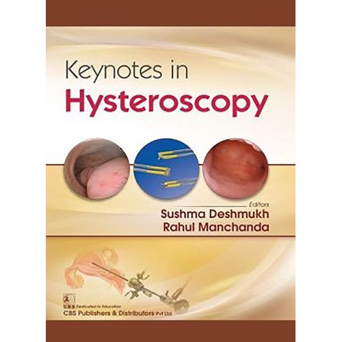 Keynotes In Hysteroscopy (Pb 2019) 