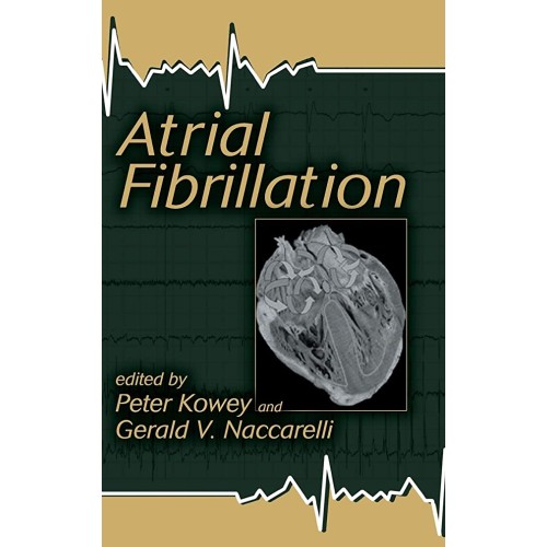 Atrial Fibrillation (Fundamental And Clinical...