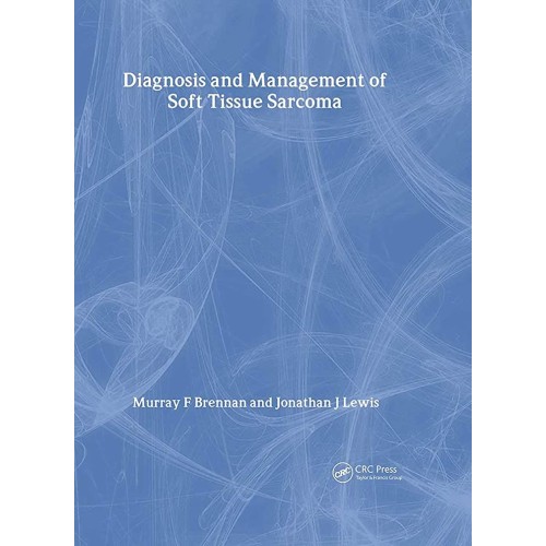 Diagnosis And Management Of Soft Tissue Sarco...