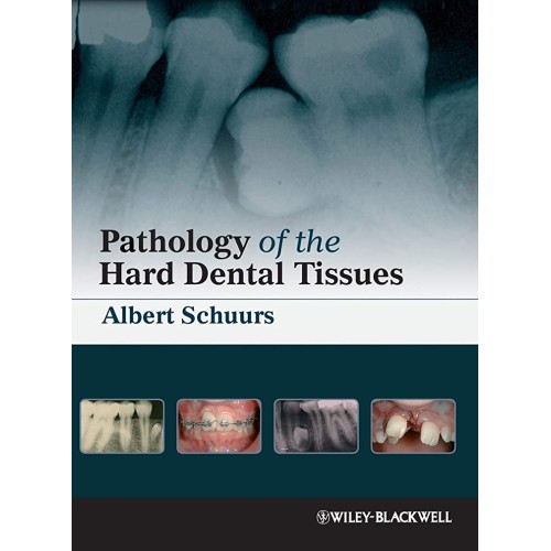 Pathology Of The Hard Dental Tissues (Hb 2013...