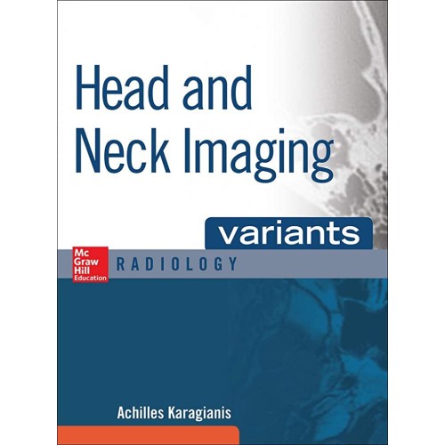 Head And Neck Imaging Variants Radiology (Hb ...