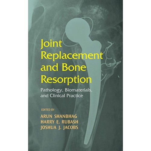 Joint Replacement And Bone Resorption Patholo...