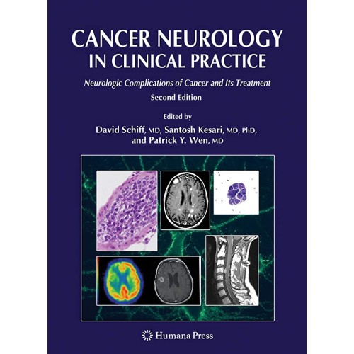 Cancer Neurology In Clinical Practice 2Ed Neu...