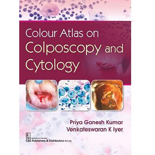 Colour Atlas On Colposcopy And Cytology (Hb 2...