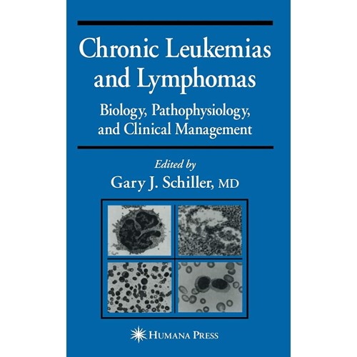 Chronic Leukemias And Lymphomas: Biology, Pat...