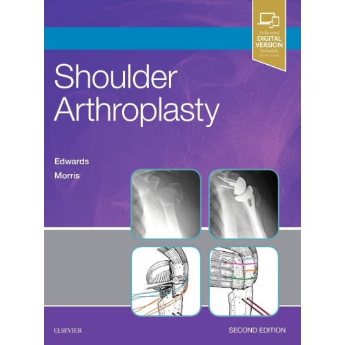 Shoulder Arthroplasty 2Ed (Hb 2019) 