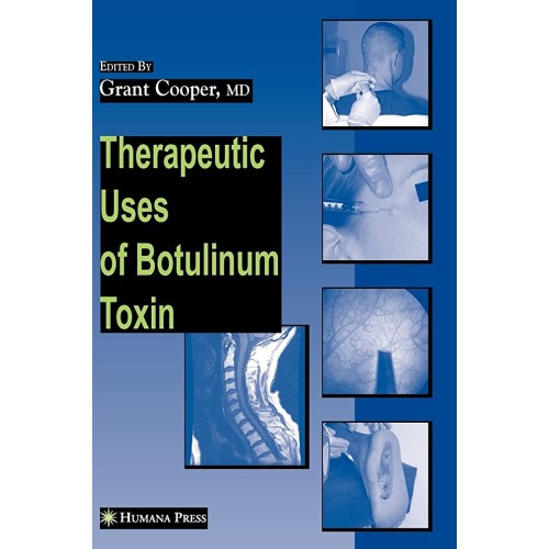 Therapeutic Uses Of Botulinum Toxin (Hb 2007)