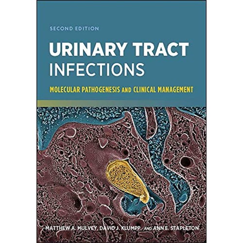 Urinary Tract Infections Molecular Pathogenes...