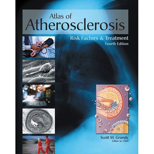 Atlas Of Atherosclerosis Risk Factors And Tre...