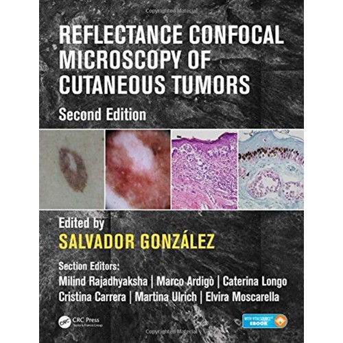 Reflectance Confocal Microscopy Of Cutaneous ...