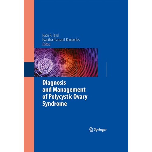 Diagnosis And Management Of Polycystic Ovary ...