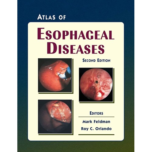 Atlas Of Esophageal Diseases 2Ed 