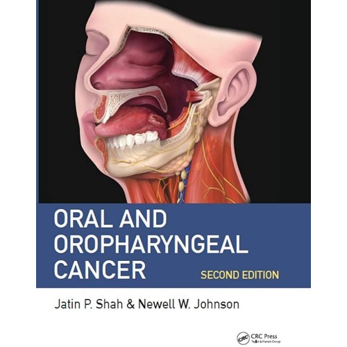 Oral And Oropharyngeal Cancer 2Ed (Pb 2020) 