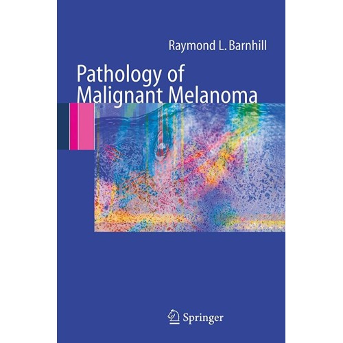 Pathology Of Malignant Melanoma (Pb) 